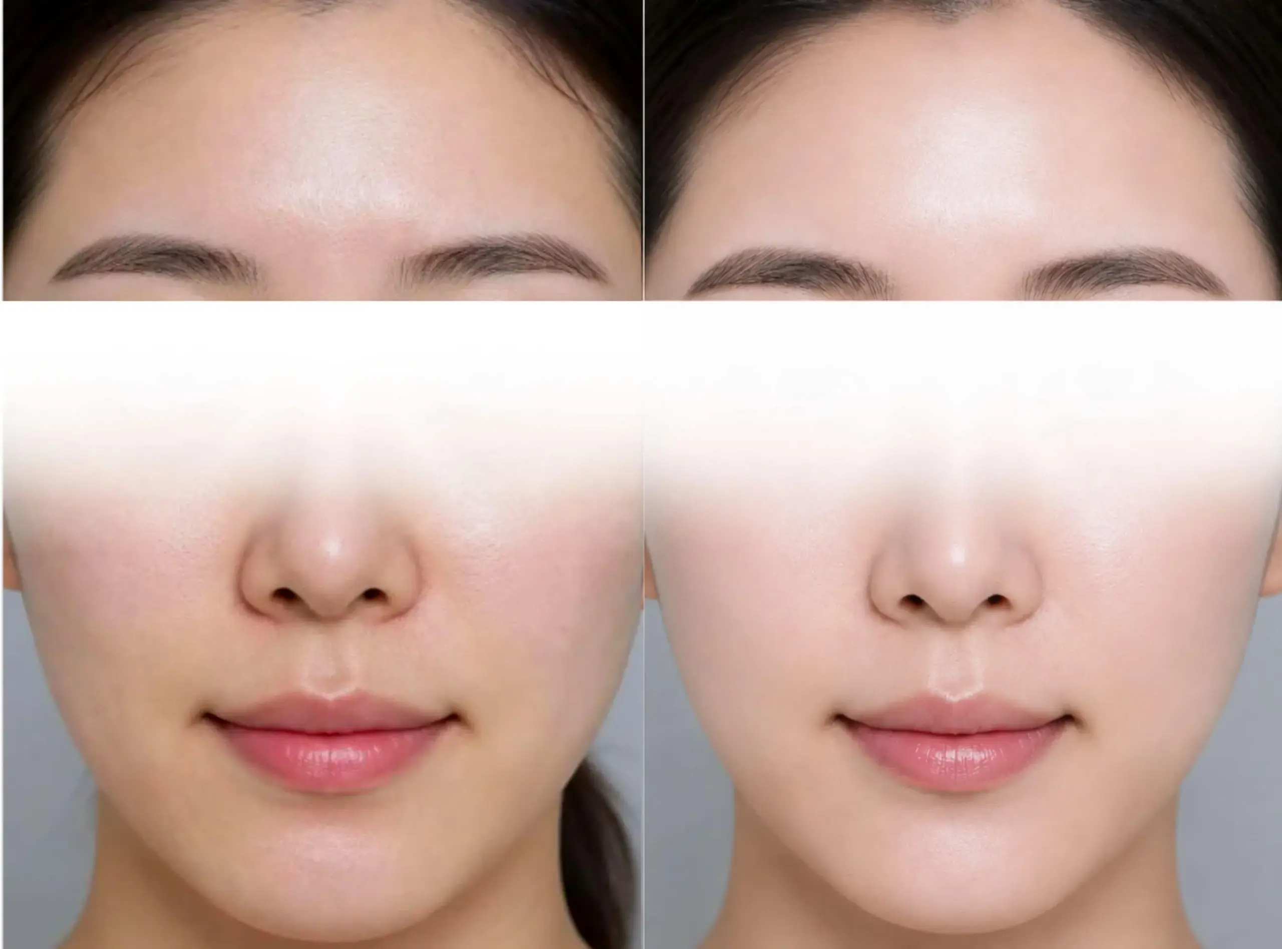 [경산 명치과] myungdental 심미치료 스킨부스터 좌